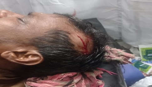 আ.লীগ প্রার্থীর সমর্থকদের বিরুদ্ধে স্বতন্ত্র প্রার্থীর সমর্থকদের ওপর হামলার অভিযোগ