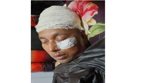 নবীনগরে উপজেলা ভাইস চেয়ারম্যান সন্ত্রাসী হামলায় গুরুতর আহত, ঢাকায় প্রেরণ