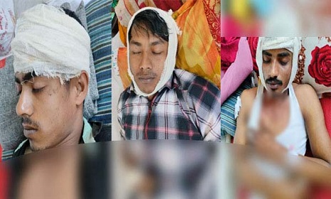 সিলেটে সরকারি গাছ কাটার মামলা নিয়ে পুলিশের গড়িমসি