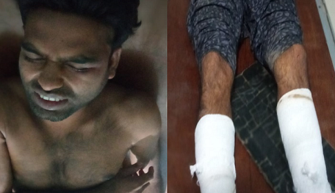 পাংশায় সন্ত্রাসী হামলার শিকার ইউপি সদস্য মহিন 