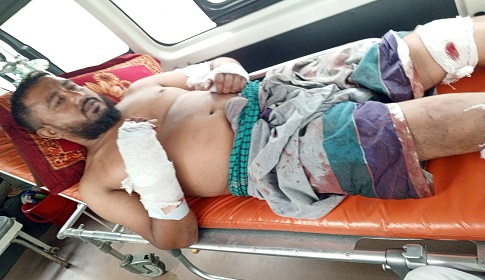 চাটমোহরে যুবলীগ নেতাকে চাপাতি দিয়ে কোপাল দুর্বৃত্তরা