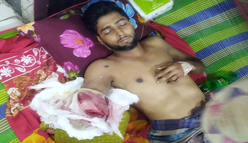 থানায় আটকে পুলিশের গুলি, হাত হারালেন কলেজছাত্র ফিরোজ