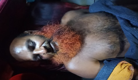 শ্যামনগরে মসজিদের ফ্যান কিনতে টাকা তোলাকে কেন্দ্র করে বৃদ্ধের পা ভেঙে দিলো প্রতিপক্ষরা
