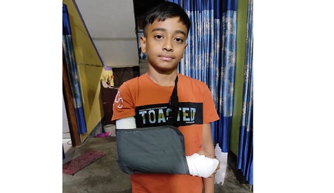 বাগেরহাটে শিক্ষকের মারপিটে শিশু শিক্ষার্থী আহত