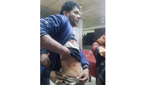 নোয়াখালীতে কৃষককে প্রকাশ্যে গুলি