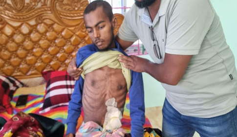 মারা গেলেন ক্যান্সারে আক্রান্ত নুরুল হুদা