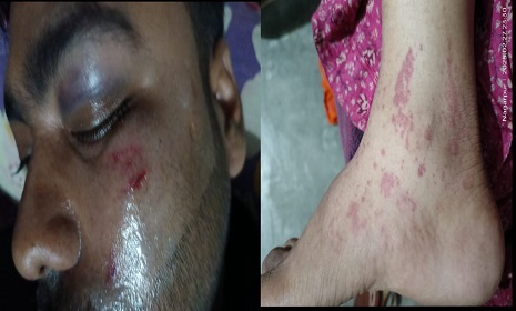 নাগরপুরে সাংবাদিকের বাসায় ডাকাতির ঘটনায় দুই জন গ্রেপ্তার