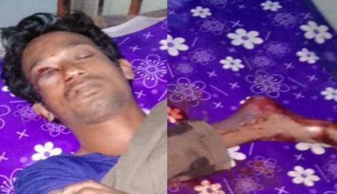 নাটোরে মাদকে বাধা দেওয়ায় যুবকের চোখ উৎপাটন ও পায়ের রগ কর্তন, আটক ১