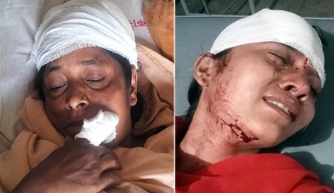 জমি দখলের জন্য ধর্ষণ চেষ্টার মামলা, মা-মেয়েকে কুপিয়ে জখম