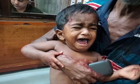 যশোরে কুড়িয়ে পাওয়া ককটেল বিস্ফোরণে ৩ শিশু আহত