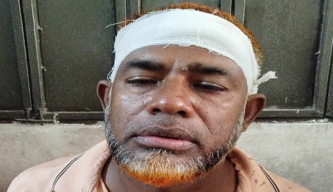 অবৈধ স্থাপনা উচ্ছেদের জেরে বিএনপি নেতাকে কুপিয়ে জখম
