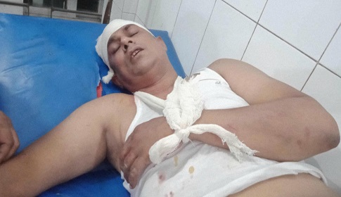 কাপাসিয়ায় আসামি ধরতে গিয়ে আহত ৫ পুলিশ সদস্য, গ্রেফতার ৫