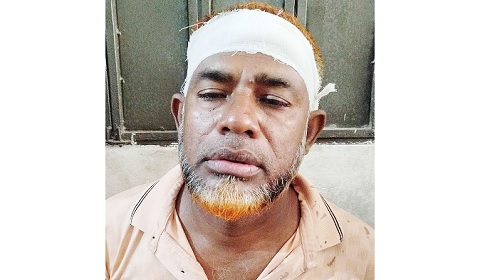 জামিনে এসে বিএনপি নেতাকে হত্যার হুমকি
