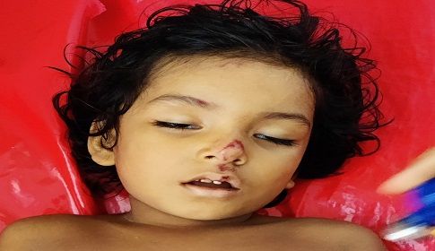 মহম্মদপুরে ইজিবাইকের ধাক্কায় শিশুর মৃত্যু
