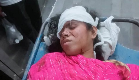 ফরিদপুরে শ্বশুরবাড়িতে গিয়ে জখম গৃহবধূ সুমী, অস্বীকার স্বামীর