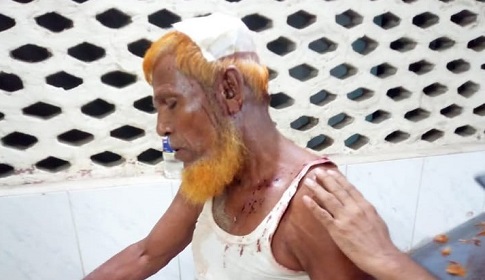 নাটোরে আ’লীগের দুই গ্রুপের পাল্টাপাল্টি হামলা, ১ জনের মৃত্যু