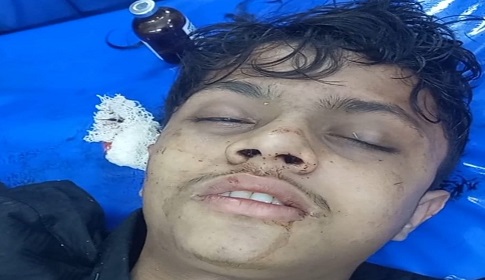 চাটমোহরে চলন্ত ট্রেন থেকে ছিটকে পড়ল তরুণ