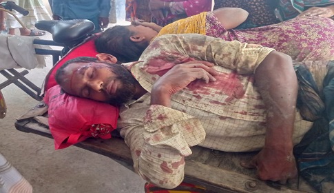 নাটোরে রাস্তা নিয়ে রক্তক্ষয়ী সংঘর্ষে এনসিপি নেতা সহ আহত ৬
