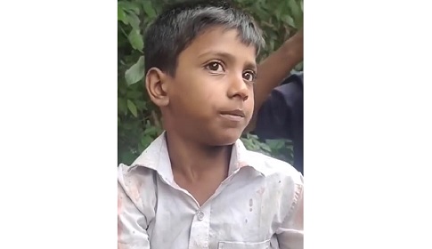 চাটমোহরে শিক্ষকের চর-থাপ্পরে রক্তাক্ত শিশু শিক্ষার্থী