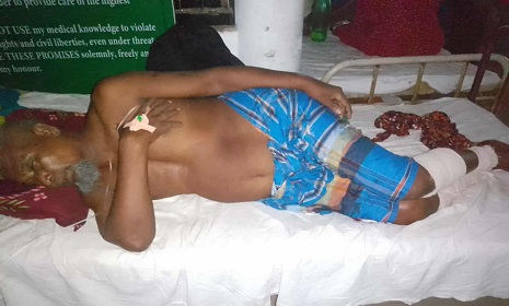 শৈলকুপায় ব্যবসায়ীর পায়ের রগ কর্তন
