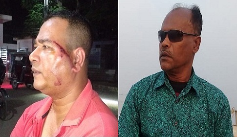 চাঁদা না পেয়ে ইতালি প্রবাসীর ওপর হামলার অভিযোগ বিএনপি নেতার বিরুদ্ধে 