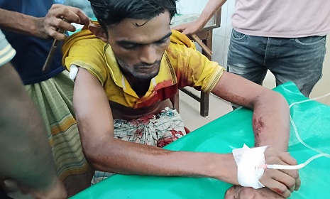 ঈশ্বরদীতে পদ্মানদীর নৌ-চ্যানেলে গোলাগুলিতে ২ যুবক আহত 
