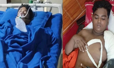 নড়াইলে দুই স্কুলছাত্রকে পিটিয়ে হত্যা চেষ্টার অভিযোগ