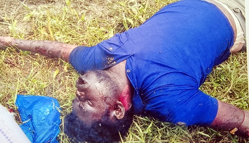 ১৫ মাসেও অজ্ঞাত ব্যক্তির লাশের পরিচয় মেলেনি