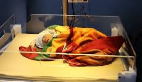 অপরিণত নবজাতকের জীবন রক্ষায় হোমিওপ্যাথি 