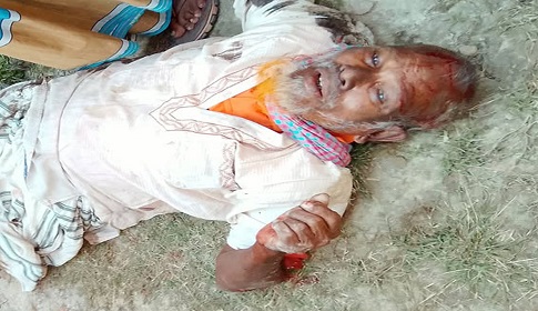 কুড়িগ্রামে ট্রেনে কাটা পড়ে আহত ব্যক্তির মৃত্যু