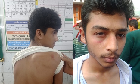 ফেসবুক পোস্ট ডিলেটকে কেন্দ্র করে সাতক্ষীরা সরকারি বালক বিদ্যালয়ে সংঘর্ষ, আহত ৩