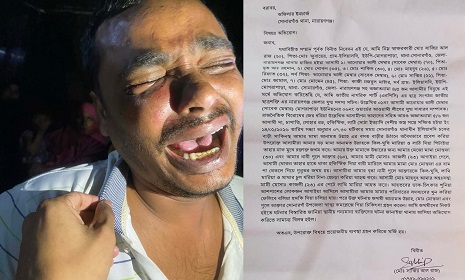 সোনারগাঁয়ে রাজনৈতিক বিরোধের জেরে হামলার অভিযোগ, আহত ৪