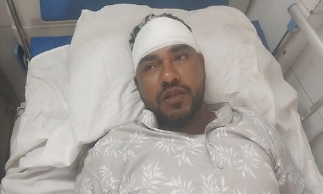 ফরিদপুরে দলীয় লিফলেট আনতে যাওয়ার পথে জায়ামাত নেতাকে কোপালো দুর্বৃত্তরা