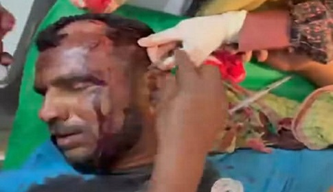 নড়াইলে আধিপত্য বিস্তারকে কেন্দ্র করে দু'পক্ষের সংঘর্ষে নারীসহ আহত ১৫ 