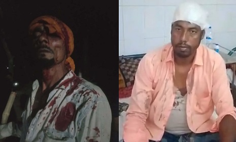 পাংশায় জমি সংক্রান্ত বিরোধে সংঘর্ষ, আহত ১৩ 