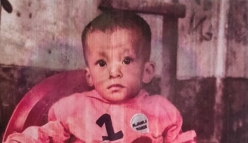 টাকার অভাবে নিভতে চলেছে ১৮ মাসের মেশিংওয়াং’র জীবন প্রদীপ