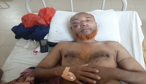 জামায়াতের দুর্গখ্যাত আগরদাঁড়িতে আ.লীগ নেতার ওপর সন্ত্রাসী হামলা