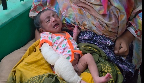 ২৪ দিনের শিশুকে পঙ্গু করে ভিক্ষাবৃত্তির চেষ্টা মাদকাসক্ত মা-বাবার