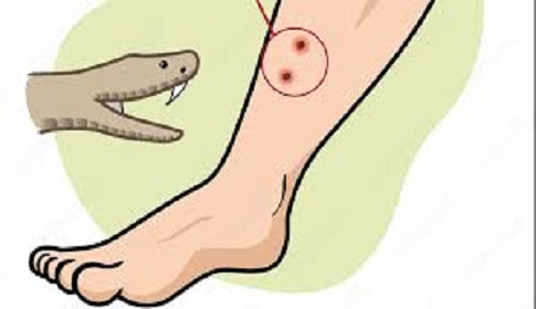 কলারোয়ায় সাপের কামড়ে কিশোরীর মৃত্যু