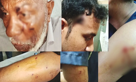 পদ্মা নদীতে টহলরত নৌ পুলিশের ওপর হামলা, ওসিসহ ৫ সদস্য গুলিবিদ্ধ