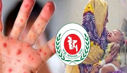 হামের উপসর্গে ১৬ জনের মৃত্যু