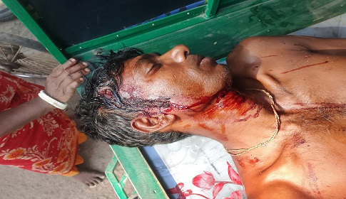 একই পরিবারের ১০ জনকে পিটিয়ে ও কুপিয়ে জখম