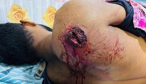 কালিগঞ্জ সীমান্তে বিএসএফের গুলিতে দুই বাংলাদেশি আহত