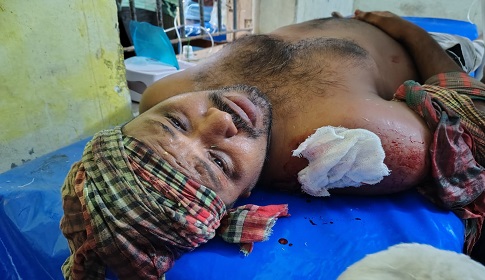 শ্যামনগরে খালের দখল নিয়ে ত্রি-মুখী সংঘর্ষ, আহত ৯