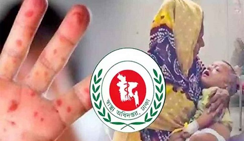 হাম ও উপসর্গ নিয়ে আরও ৫ শিশুর মৃত্যু