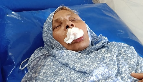 বৃদ্ধা মাকে পিটিয়ে দাঁত ভাঙার অভিযোগে শিক্ষক ছেলের বিরুদ্ধে থানায় মামলা