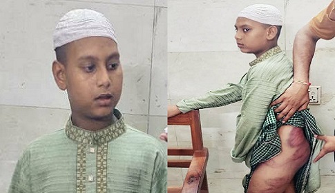পাবনায় মাদ্রাসা ছাত্রকে চুরির অপবাদে নির্যাতন, শিক্ষক আটক