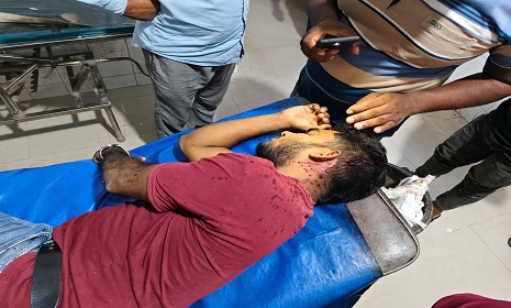 পাংশায় যাত্রী হয়রানির সংবাদ সংগ্রহ করতে গিয়ে সাংবাদিক ও সেচ্ছাসেবক আহত