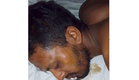 ফরিদপুরে মাদকের বিরুদ্ধে বক্তব্য রাখায় মারধরের অভিযোগ, থানায় মামলা