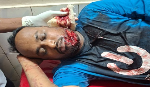 প্রাইভেটকারে গুলি করে স্বেচ্ছাসেবক দল নেতাকে কুপিয়ে জখম